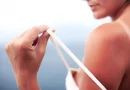 Arsurile solare care îți pot dubla riscul de cancer. Ce spun specialiștii